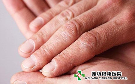 牛皮癬中醫病理是什么?初期癥狀表現? 牛皮癬中醫病理是什么?初期癥狀表現?