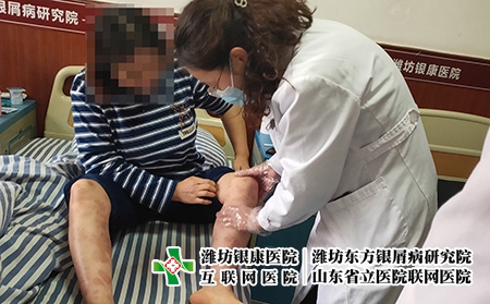 濰坊治療皮膚病院是哪家-濰坊治皮膚病到哪個專業