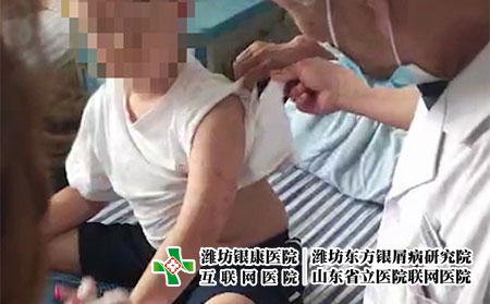 濰坊皮膚病醫院簡介-濰坊市皮膚病治療法 濰坊皮膚病醫院簡介-濰坊市皮膚病治療法