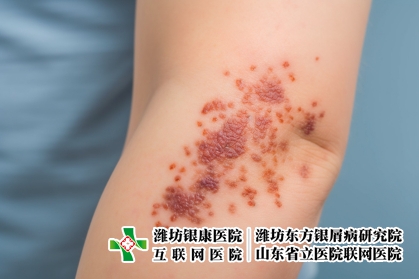 攝圖網(wǎng)_600370515_牛皮癬類型(企業(yè)商用)_副本 攝圖網(wǎng)_600370515_牛皮癬類型(企業(yè)商用)_副本