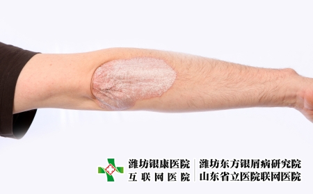 攝圖網_327921215_微絲蟲病藥物皮膚濕疹疾病人體皮疹皮炎痛苦燒傷醫生(企業商用) 攝圖網_327921215_微絲蟲病藥物皮膚濕疹疾病人體皮疹皮炎痛苦燒傷醫生(企業商用)