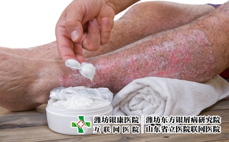 攝圖網(wǎng)_502709980_皮絲蟲病是皮膚慢發(fā)炎疾病(企業(yè)商用) 攝圖網(wǎng)_502709980_皮絲蟲病是皮膚慢發(fā)炎疾病(企業(yè)商用)