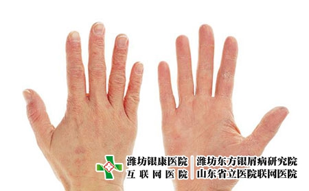 2 (281)手 2 (281)手