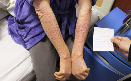 濰坊銀屑病良專業的治療醫院