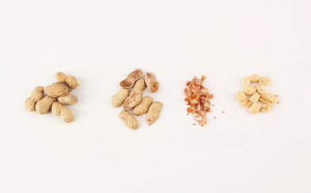 孩子銀屑病,兒童銀屑病,濰坊東方銀屑病研究院