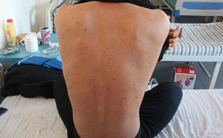 濰坊皮膚病醫院口碑