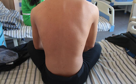 濰坊皮膚病貴嗎