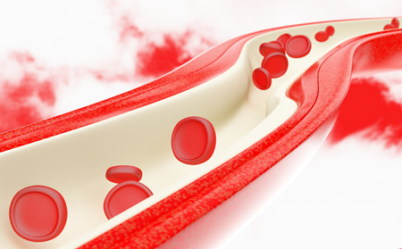 紅斑狼瘡預(yù)防,怎樣預(yù)防紅斑狼瘡