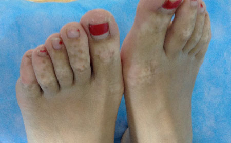 治療白癜風醫院