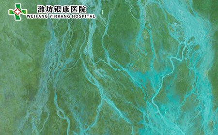 小兒過敏性紫癜的發病因素有哪些?可以吃紫薯嗎?